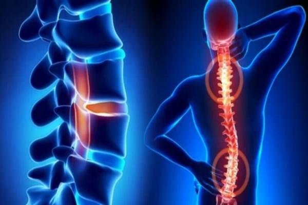 علائم بیماری های ستون فقرات چیست؟ 5 نشانه از علائم بیماری های ستون فقرات